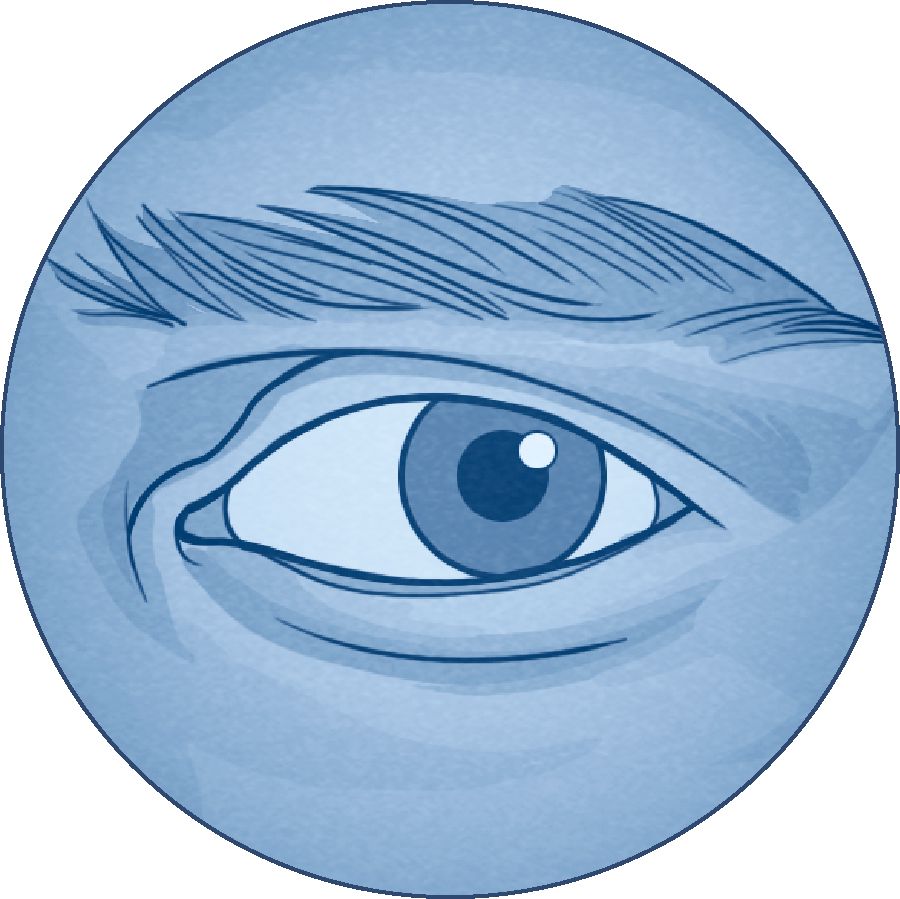 An eye