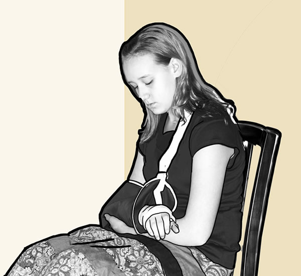 A teenage girl recovering from a broken arm
